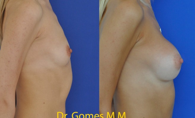 профиль увел 4 мес  c подписью