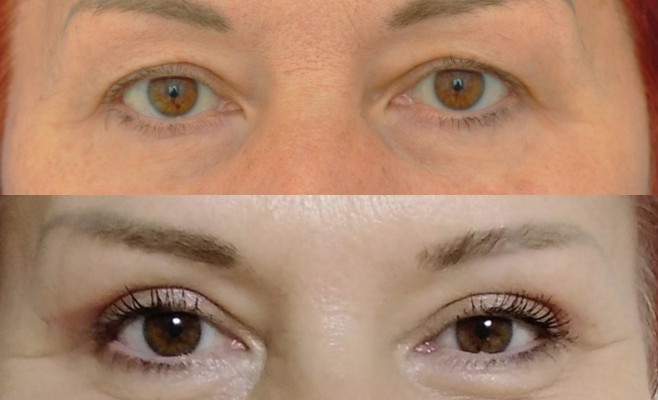 верх п_о 3 мес